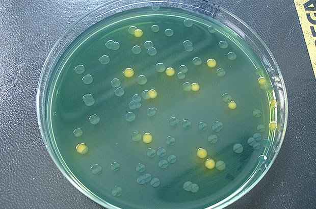 Vibrio strains on a plate