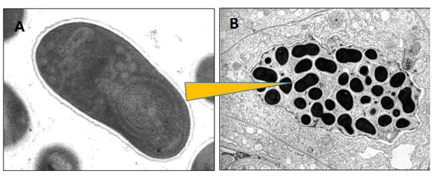 Microsporidia