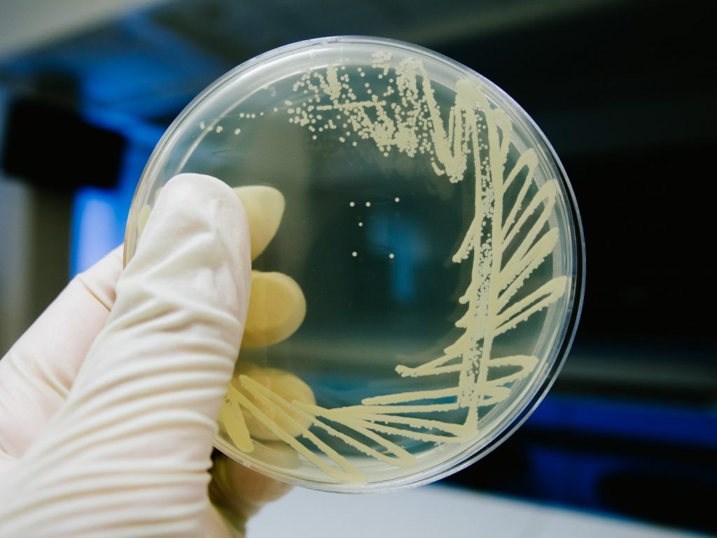 Bacterial growth on a petri dish plate