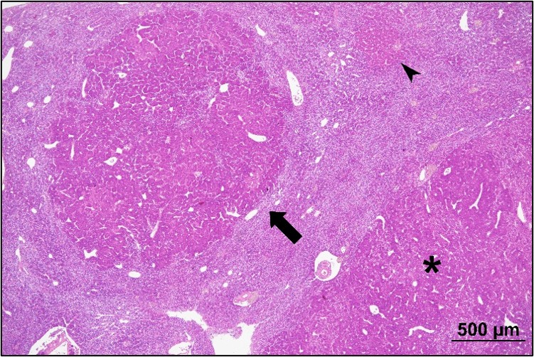 pink image of dab cells and liver tumours